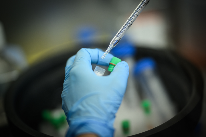 Des fonds frais pour Abivax après son introduction au Nasdaq - © Photo by LOIC VENANCE / AFP